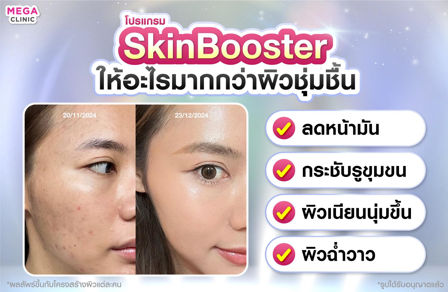 เมโสชาแนลยังช่วยอะไรได้อีก