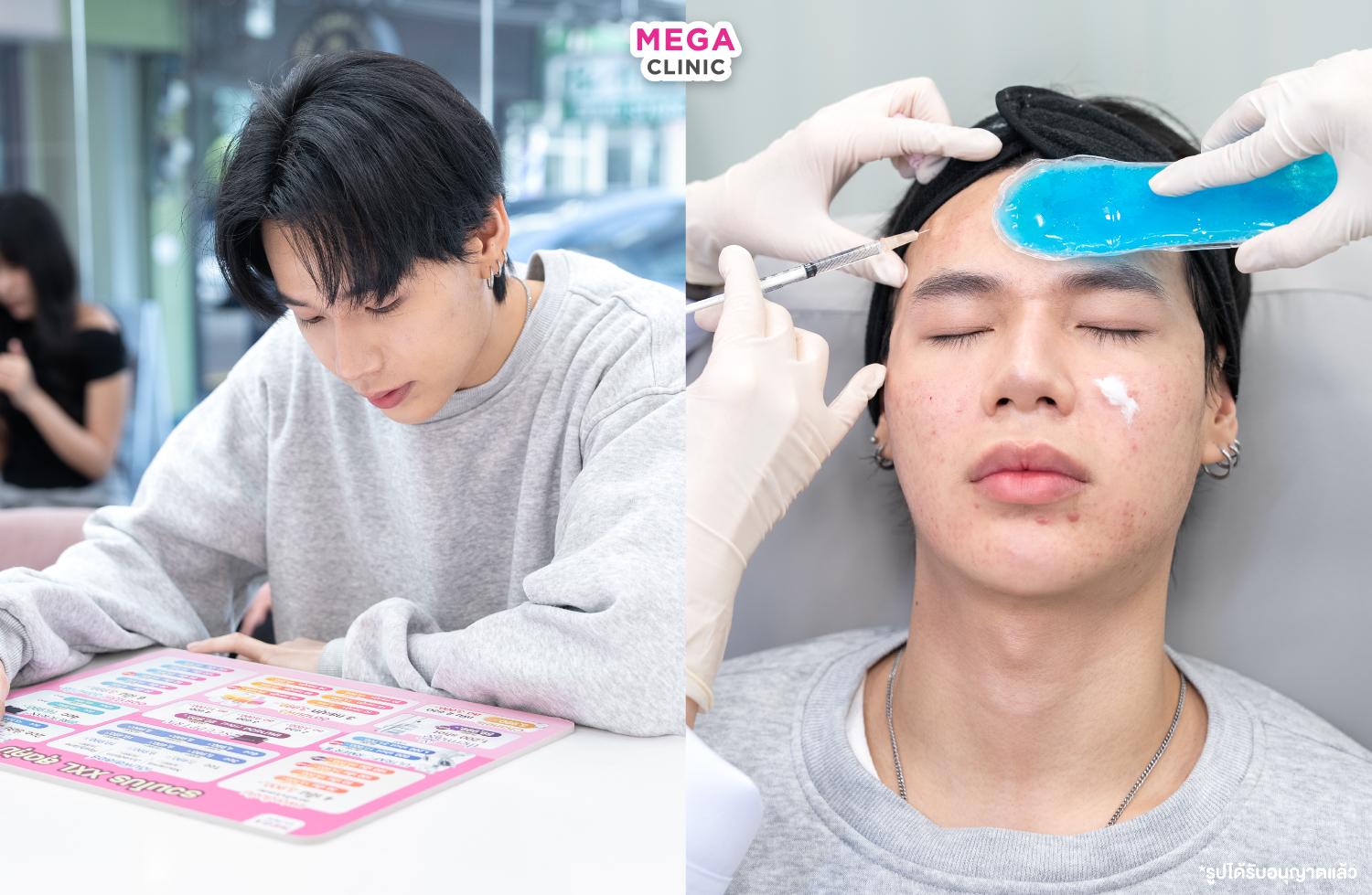 ตัดสินใจเลือกหัตถการ และขณะฉีดโบท็อก