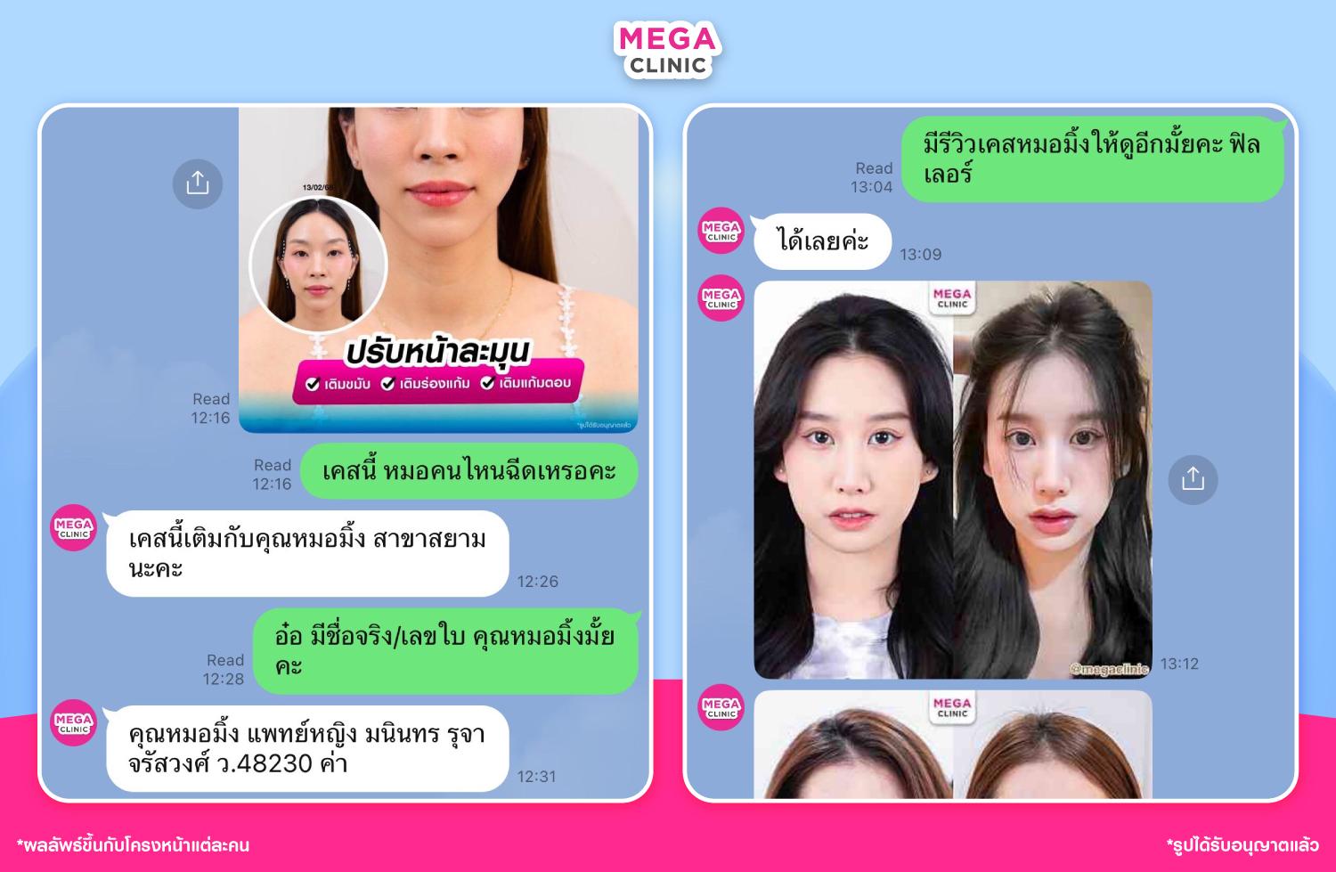 ขั้นตอนเช็คชื่อหมอผ่านแชทไลน์