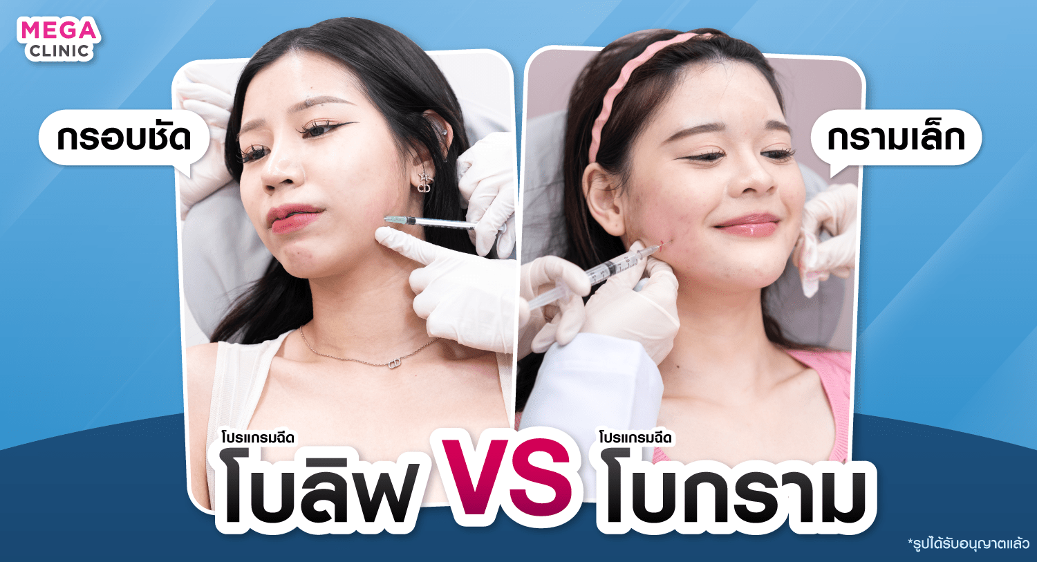 โบลิฟกรอบหน้า กับ โบกราม ต่างกันยังไง?