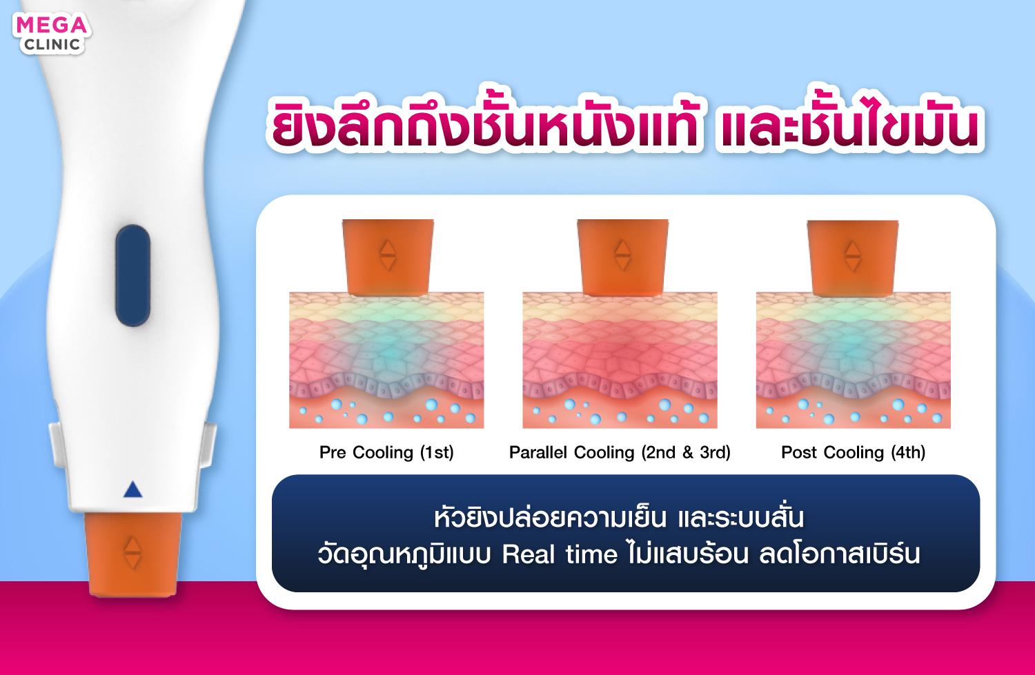 เทคโนโลยีของ Oligio การทำงาน