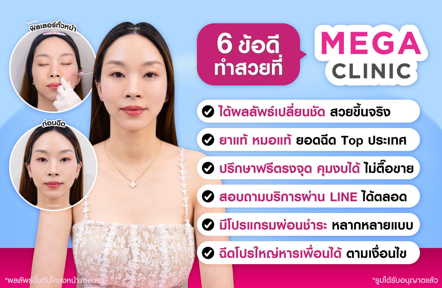 6 ข้อดี ทำสวยที่ MEGA CLINIC