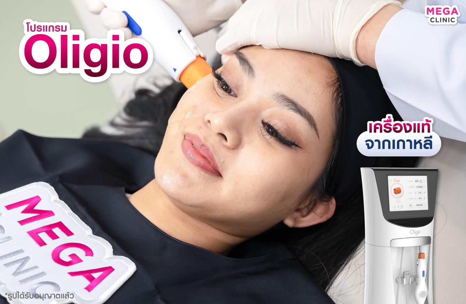 เทอร์มาจเกาหลี Oligio