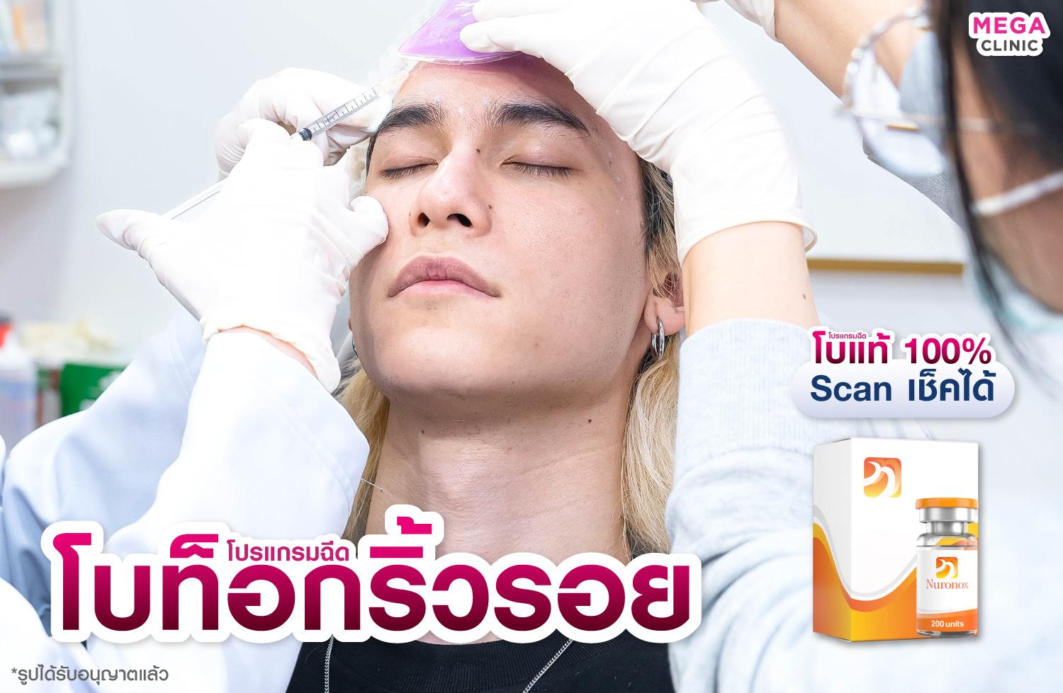 ฉีดโบท็อก ลดริ้วรอยจากการแสดงสีหน้า