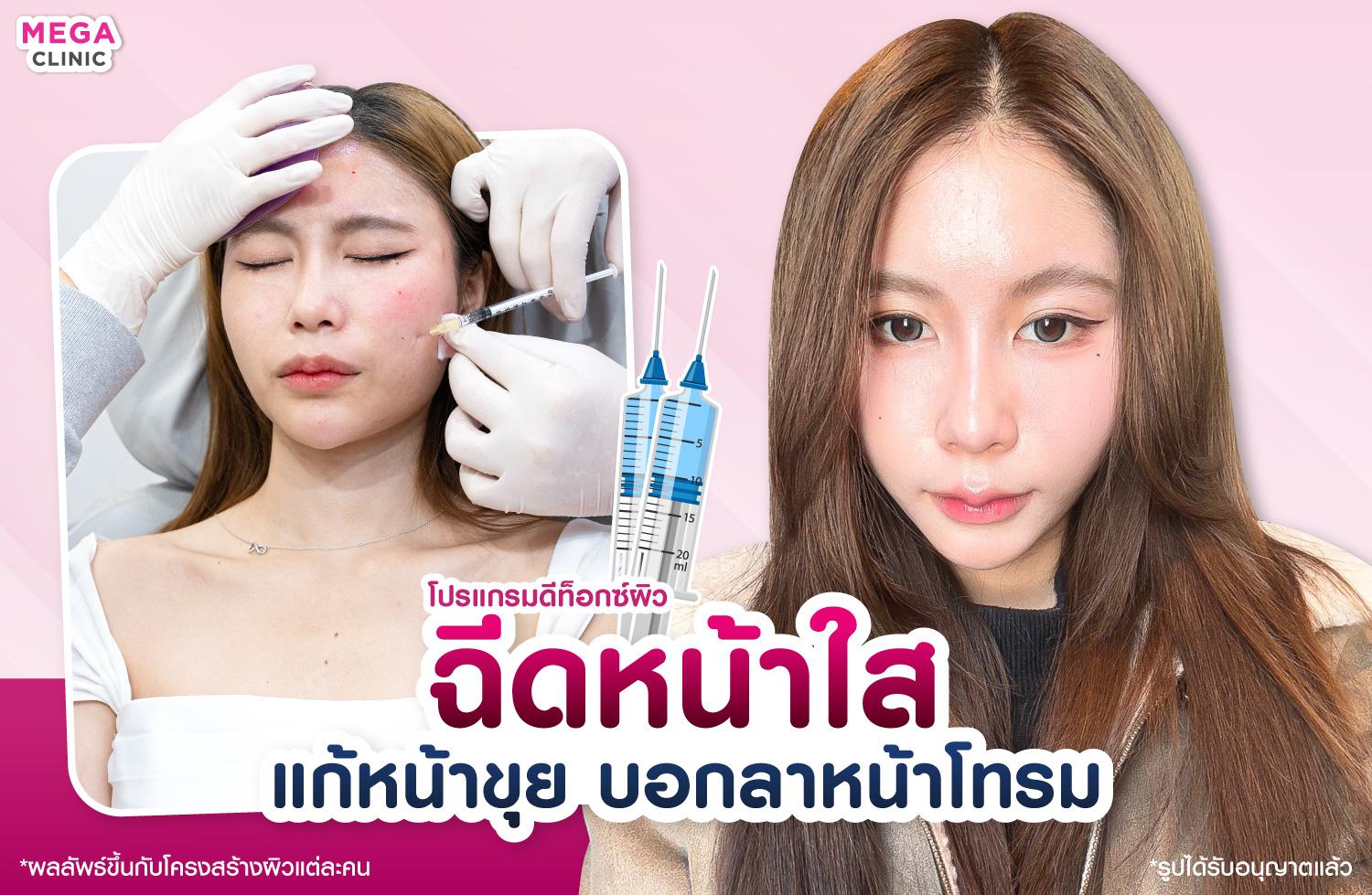 ฉีดหน้าใส ปรับสมดุลผิว เพิ่มความชุ่มชื้นให้ผิว แต่งหน้าติดทน