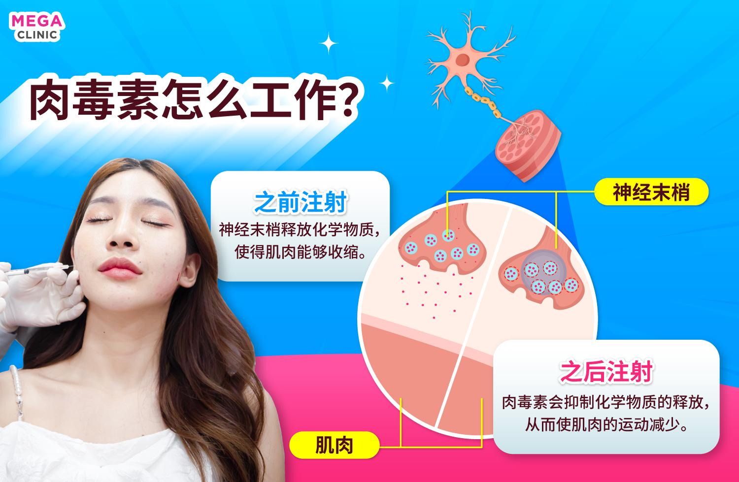 โบท็อก ทำงานและออกฤทธิ์อย่างไร?
