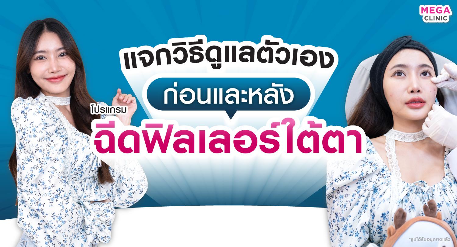 การดูแลตัวเองหลังฉีดฟิลเลอร์ใต้ตา