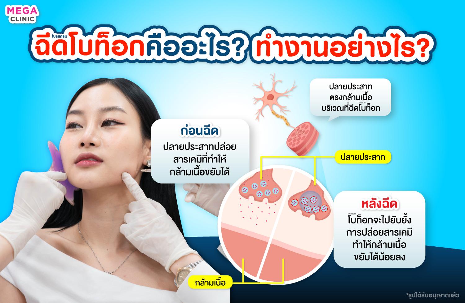 ฉีดโบท็อกคืออะไร