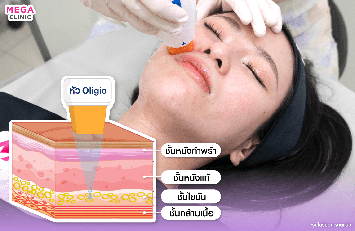 การทำงานของเครื่อง โอริจิโอ้