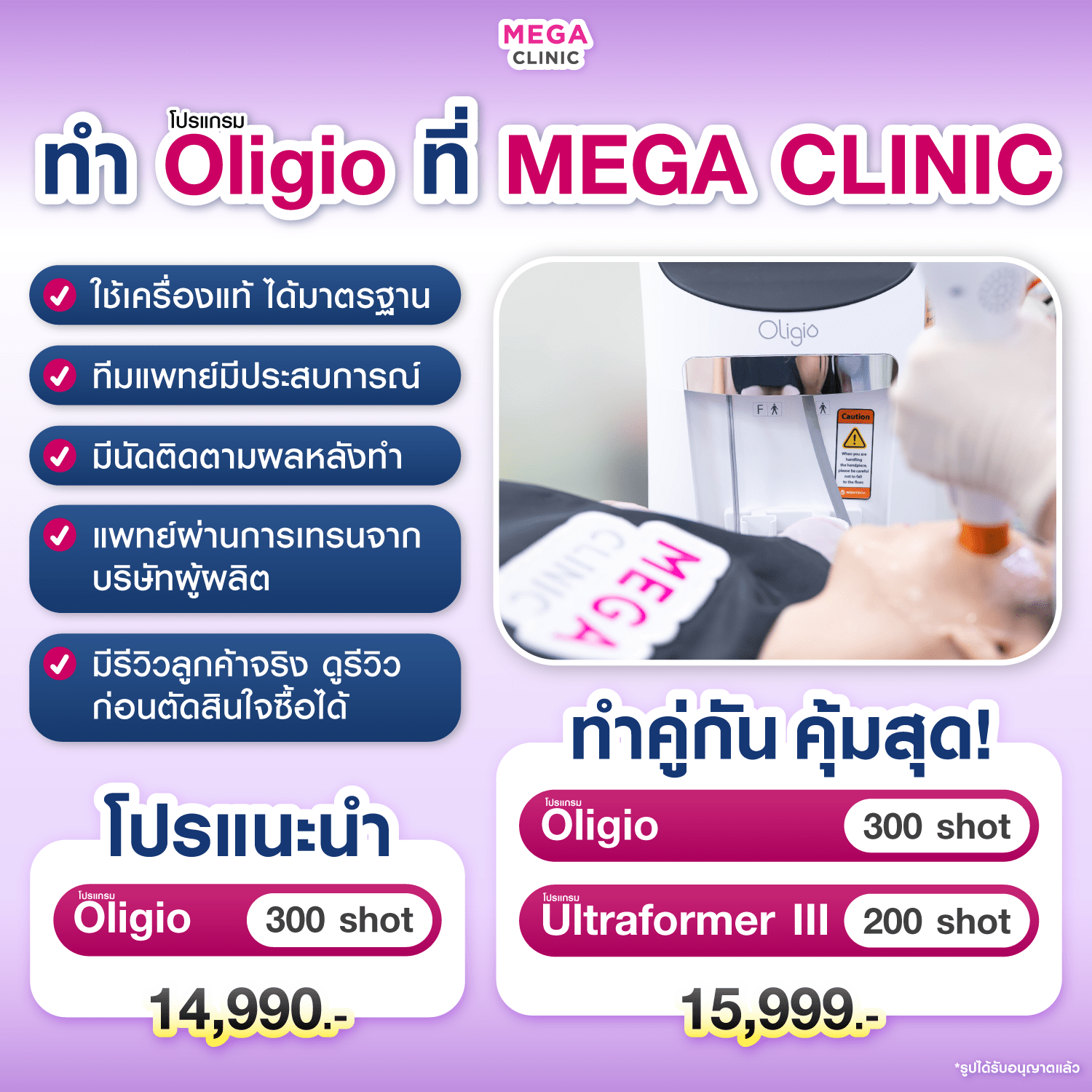 ทำ Oligio ที่ MEGA CLINIC ข้อดี