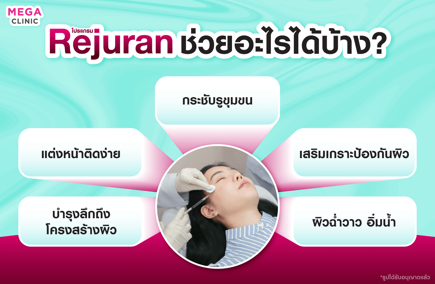 Rejuran ช่วยอะไรได้อีกบ้าง?