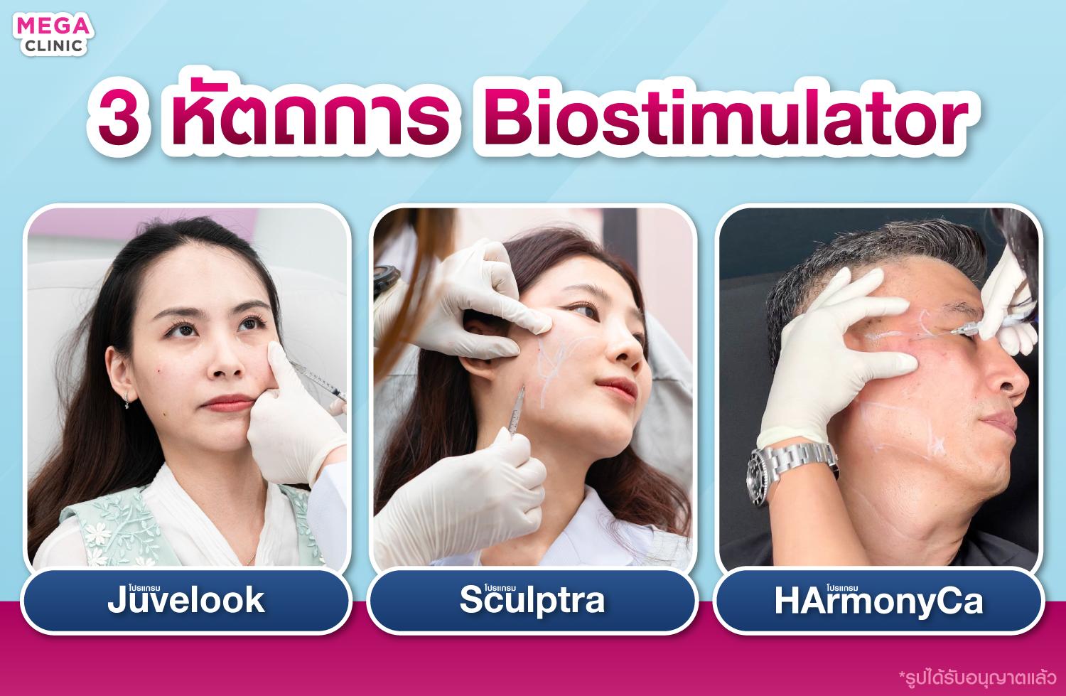 หัตถการกระตุ้นคอลลาเจนใบหน้า