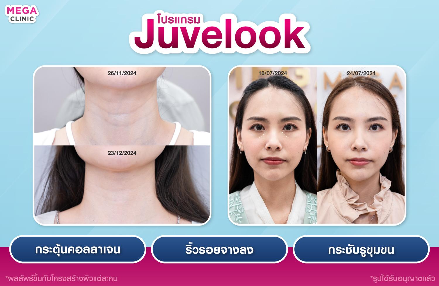 juvelook ช่วยอะไร