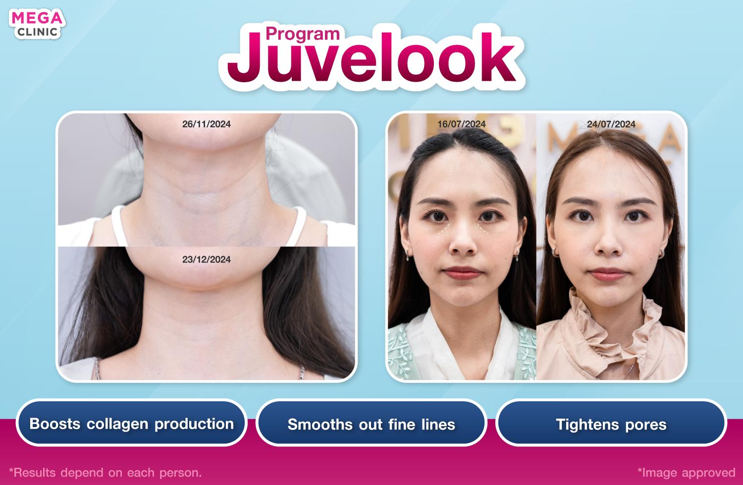 juvelook ช่วยอะไร
