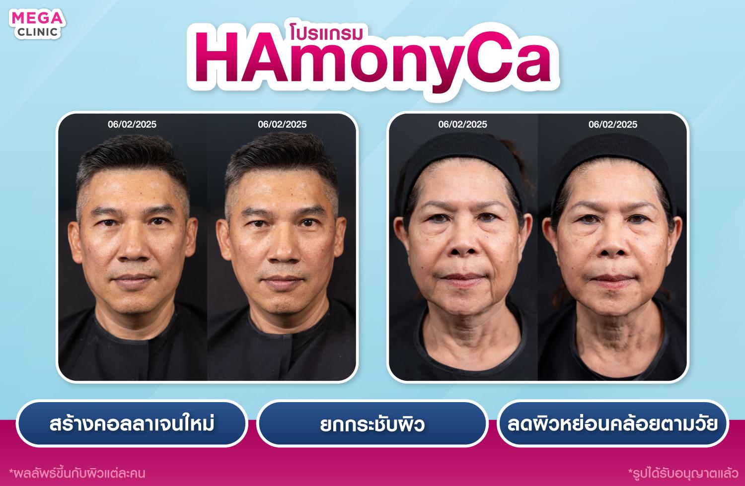 HArmonyCa ช่วยอะไร