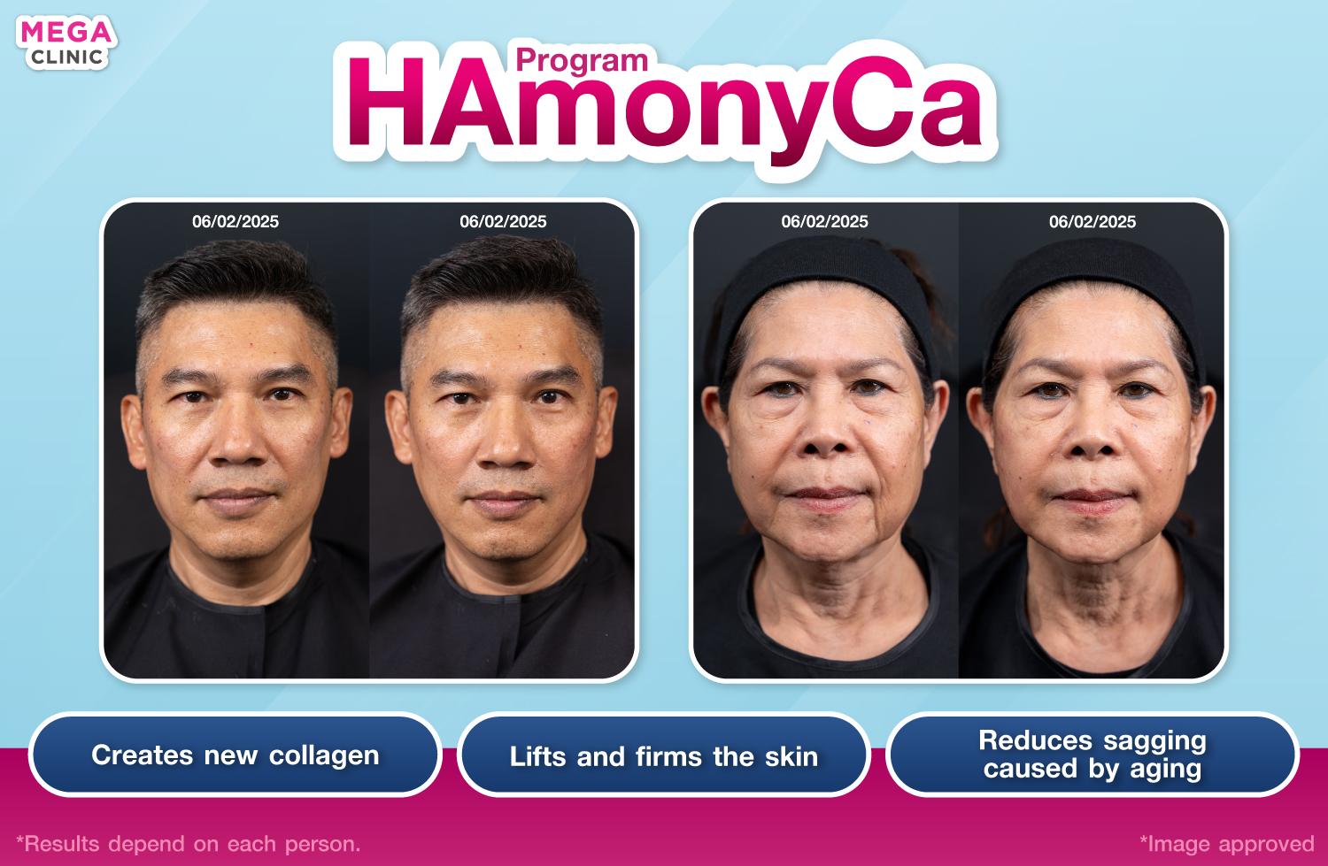 HArmonyCa ช่วยอะไร