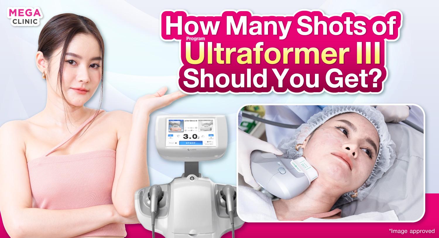 Ultraformer III ควรทํากี่ช็อตถึงเห็นผล