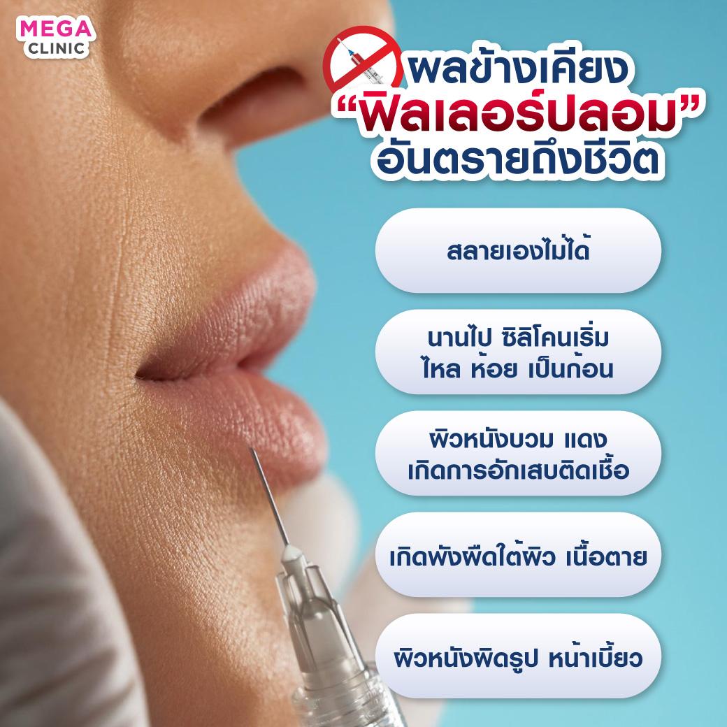 เลือกคลินิกฉีดฟิลเลอร์ปาก Neuramis ต้องดูอะไรบ้าง