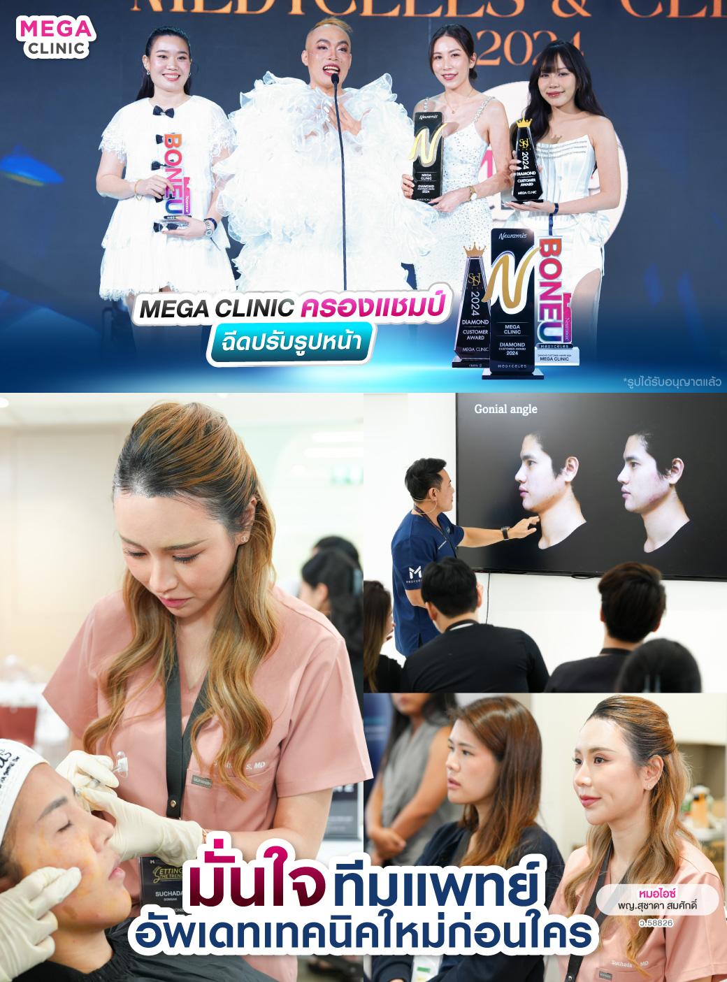 MEGA CLINIC ครองแชมป์ฉีดปรับรูปหน้า ทีมแพทย์ฝีมือระดับเทพ