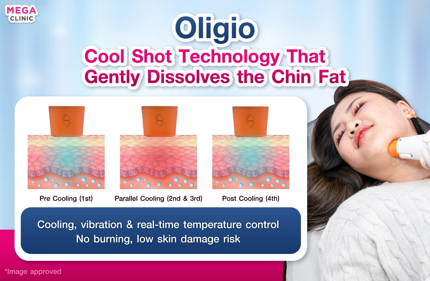 การทำงานของ oligio สำหรับการ ลดเหนียง