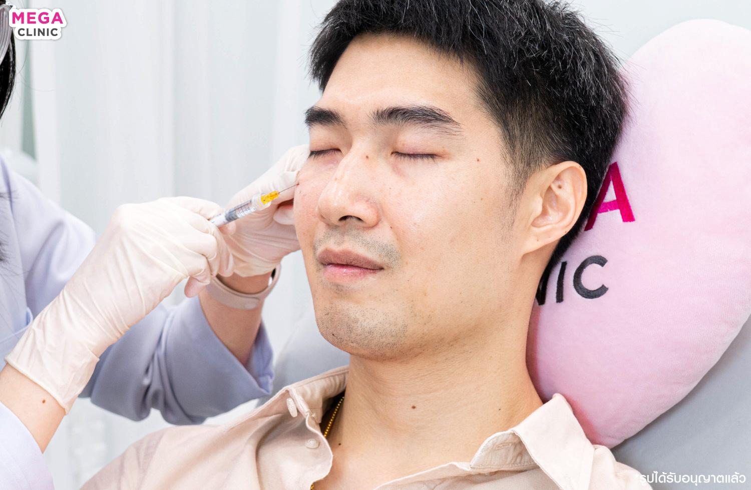 BLOG_27042025_pround_4 ขณะ ฉีดฟิลเลอร์ ใต้ตา