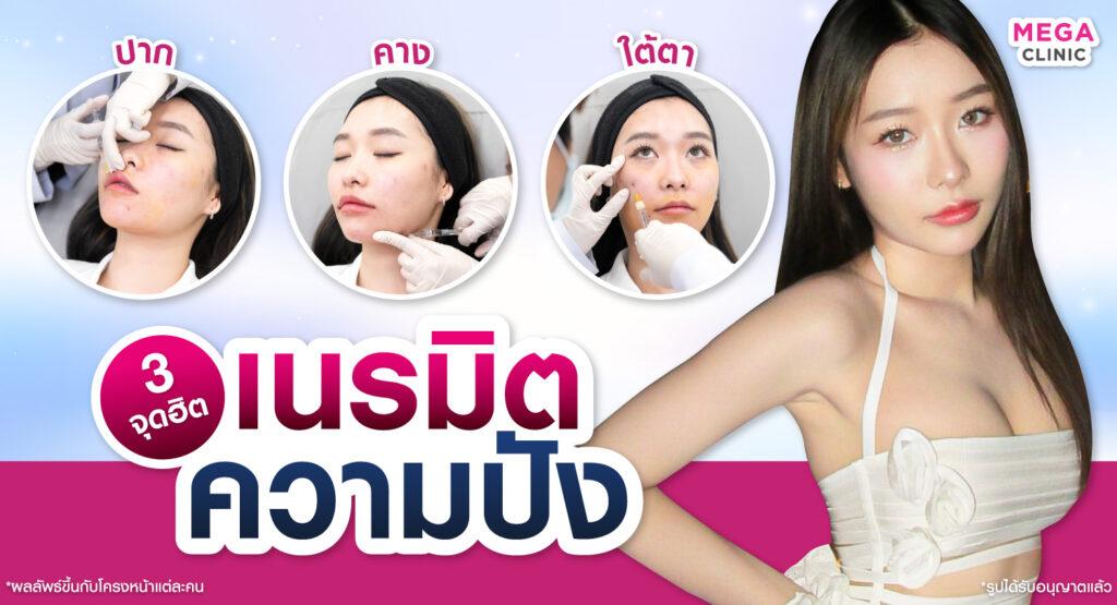 จุด ฉีดฟิลเลอร์ เติมตรงไหนให้สวยละมุน
