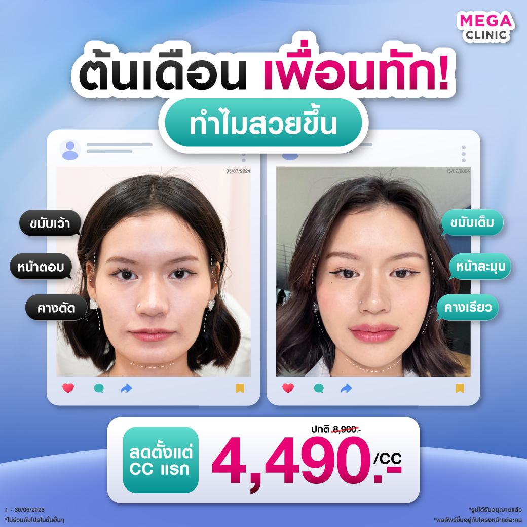 FB_03062025_PIM