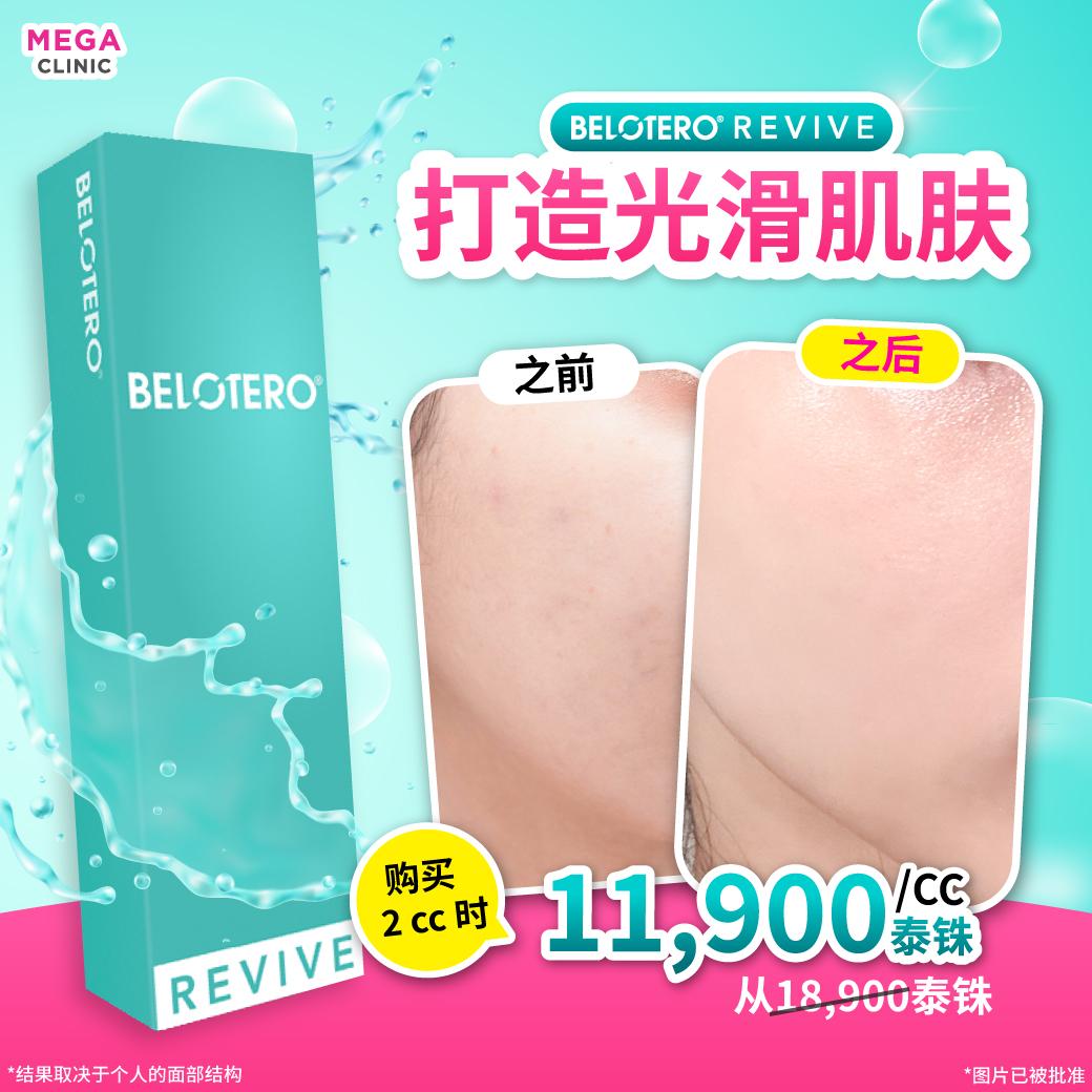 ราคาฟิลเลอร์ Belotero revive