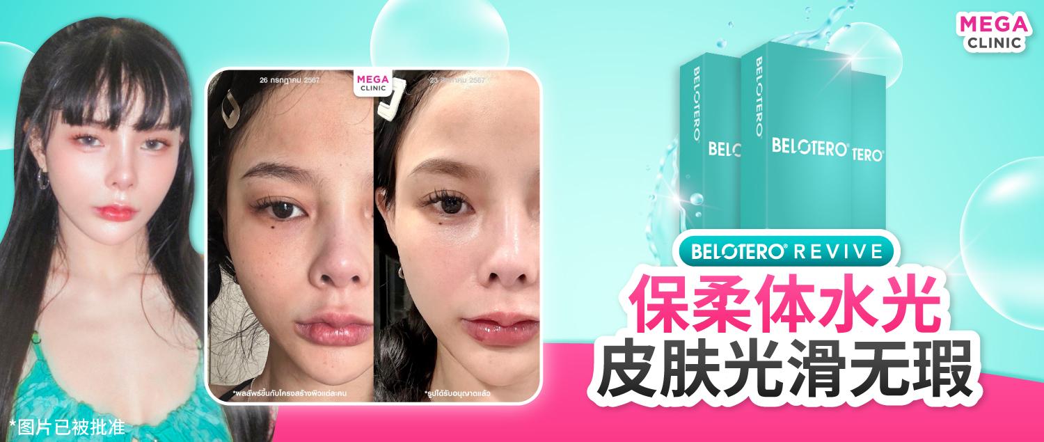 ฟิลเลอร์ Belotero Revive