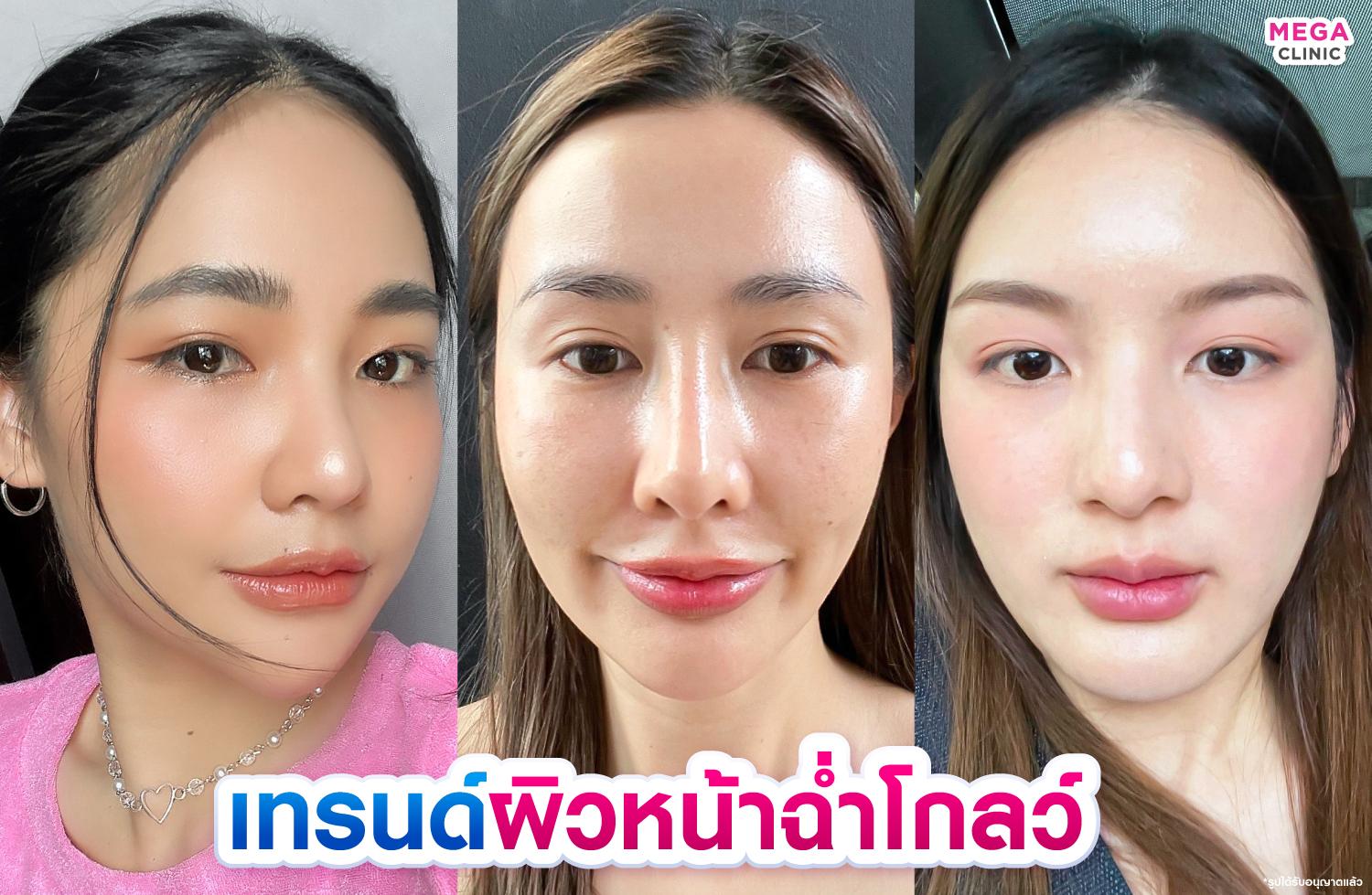 รีวิวผิวหน้าฉ่ำโกลว์