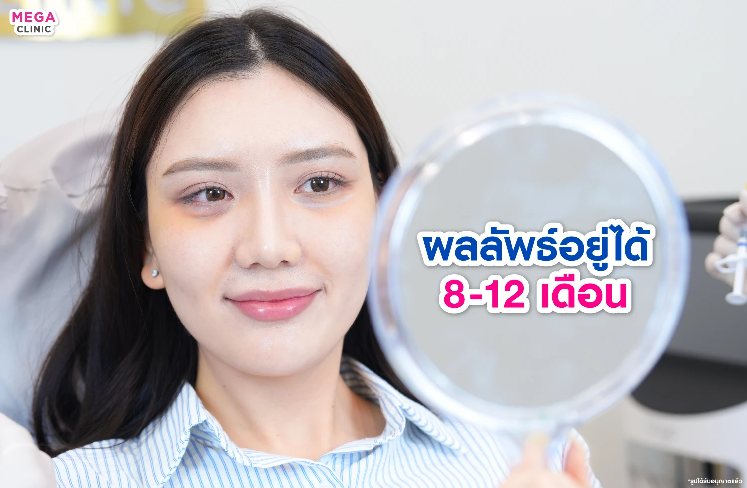 ฉีดดอลลี่อาย อยู่ได้นานกี่เดือน