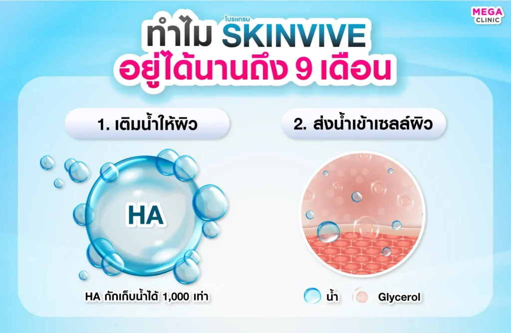 หลักการทำงานของสกินวิฟฟ์