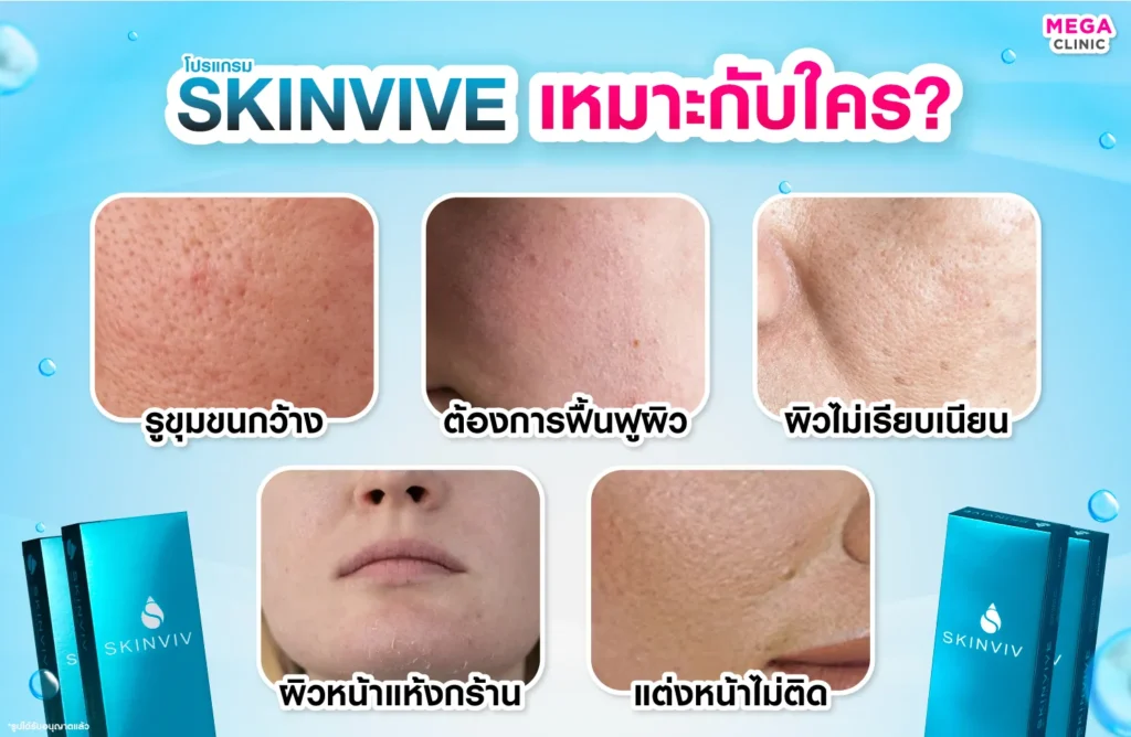 Skinvive เหมาะกับใคร