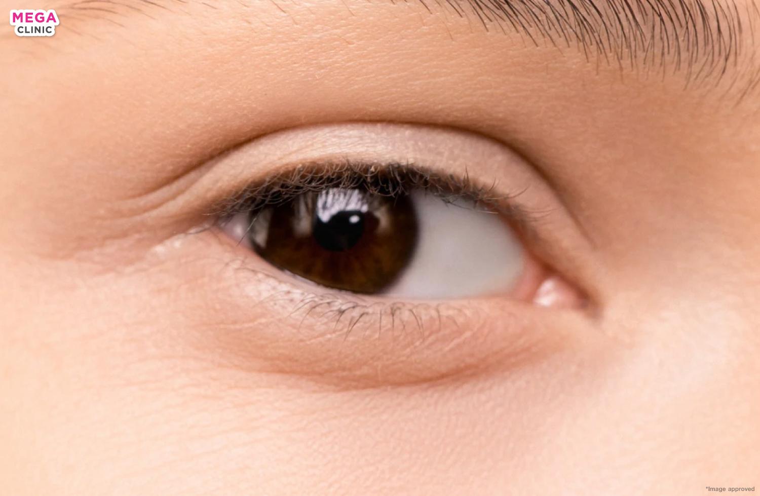 Dolly Eyes