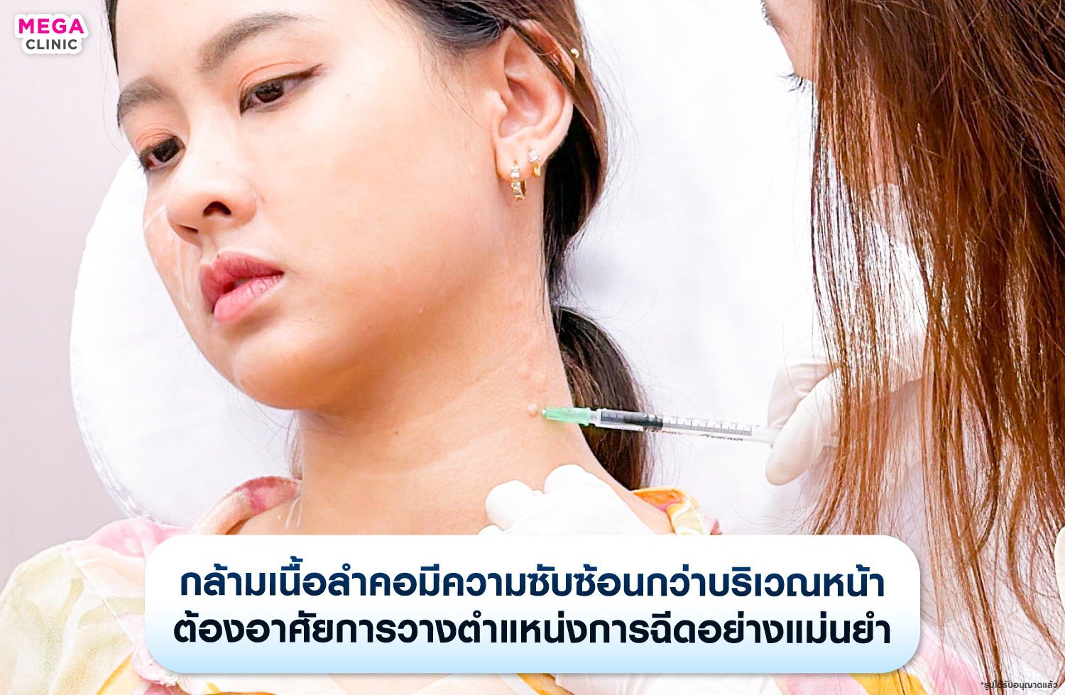 โบท็อกคอ