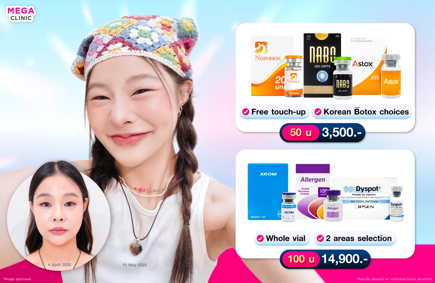 V-shaped jaw Botox price