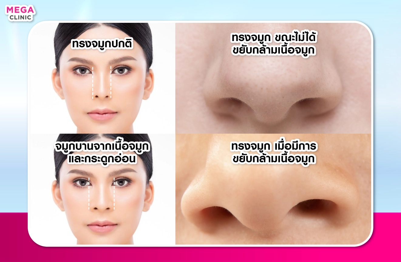 จมูกบาน