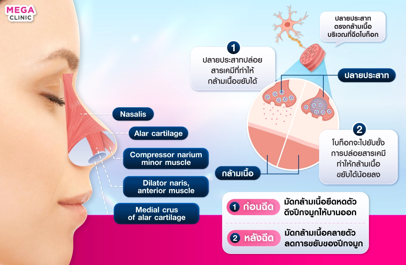 โบท็อกปีกจมูก ช่วยอะไร