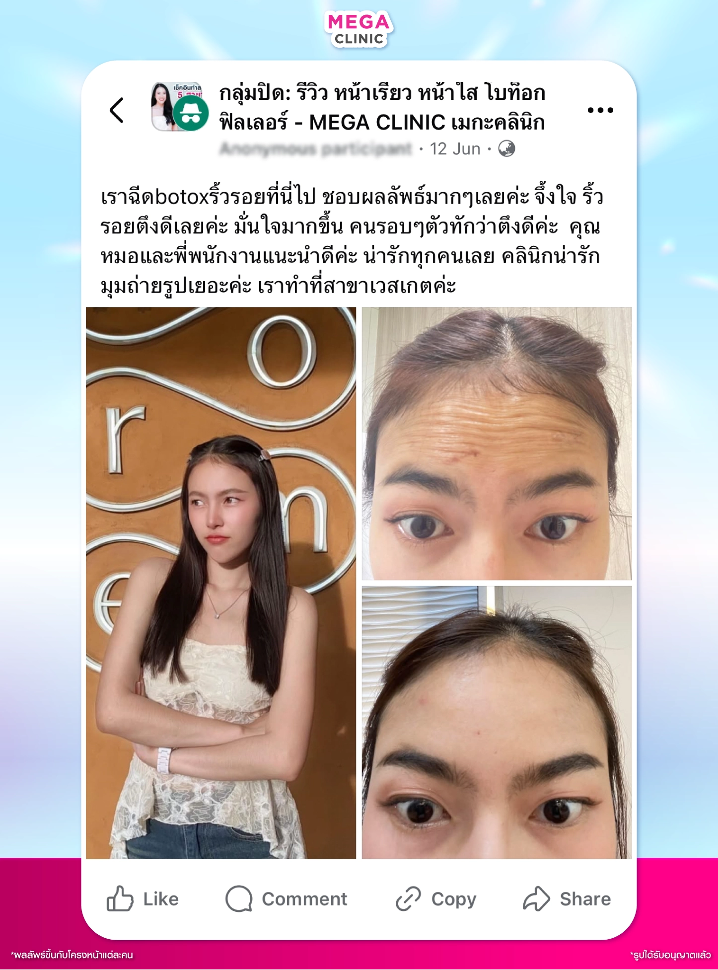 โบท็อก ริ้วรอย รีวิว