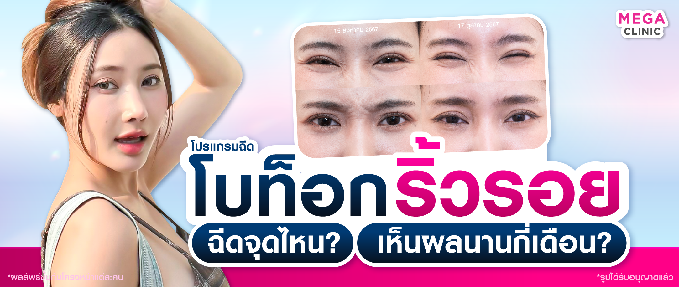 โบท็อก ริ้วรอย
