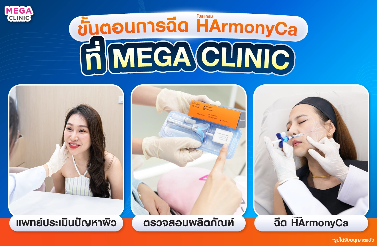 ฉีด ฮาโมนิก้า ที่ MEGA CLINIC