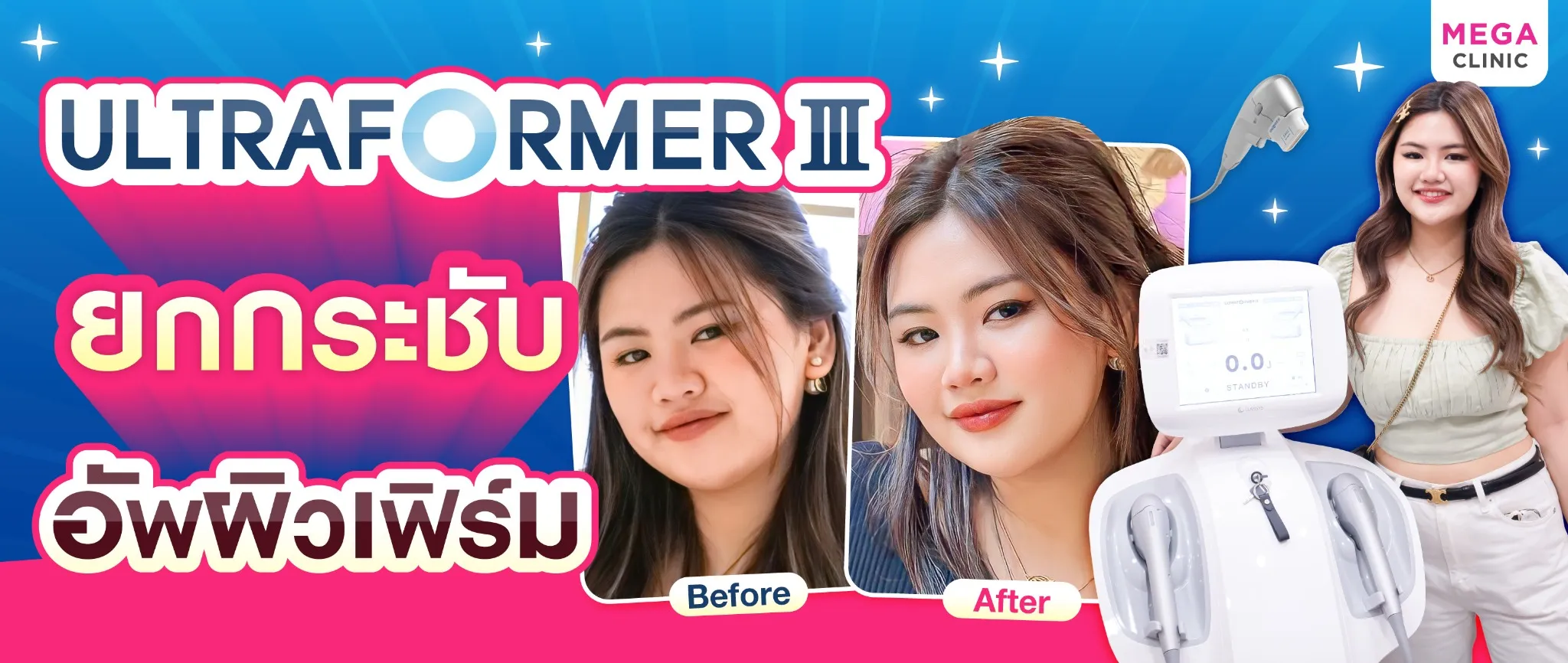 Ultraformer III