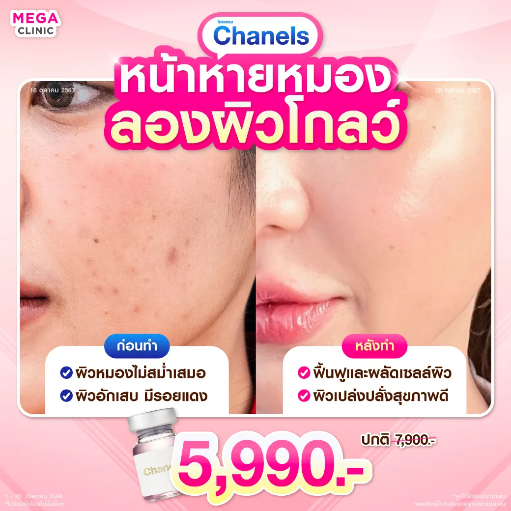 AWแปล_18092025_Mickey_1_result