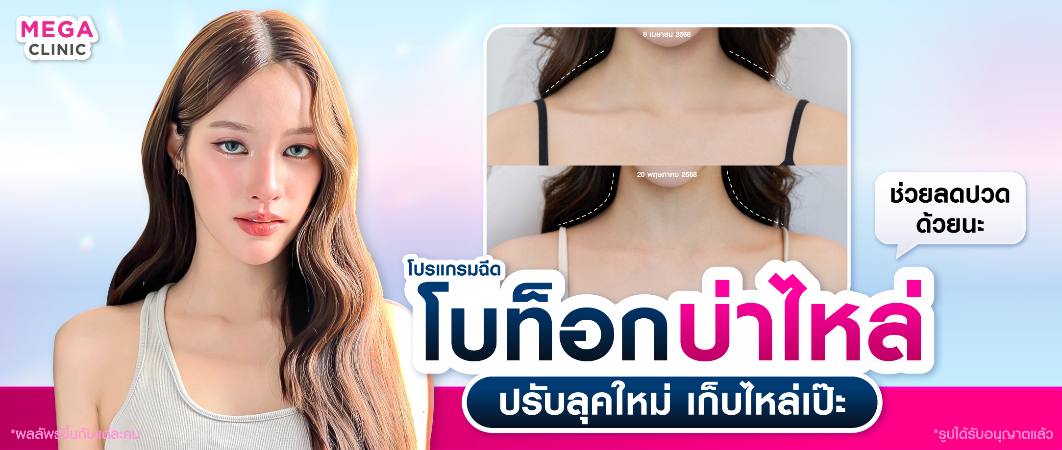 คอสั้น ไหล่หนา ปรับได้ด้วยโบท็อกบ่าไหล่