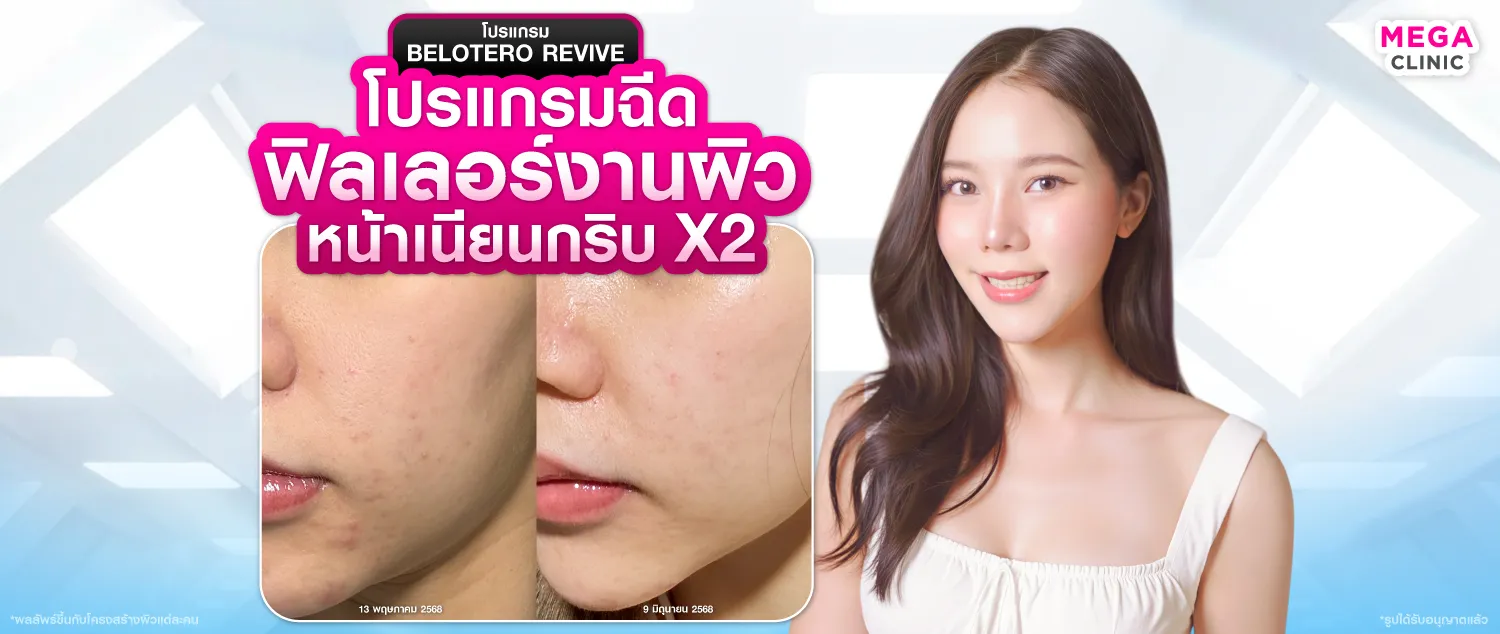 Belotero Revive คือ