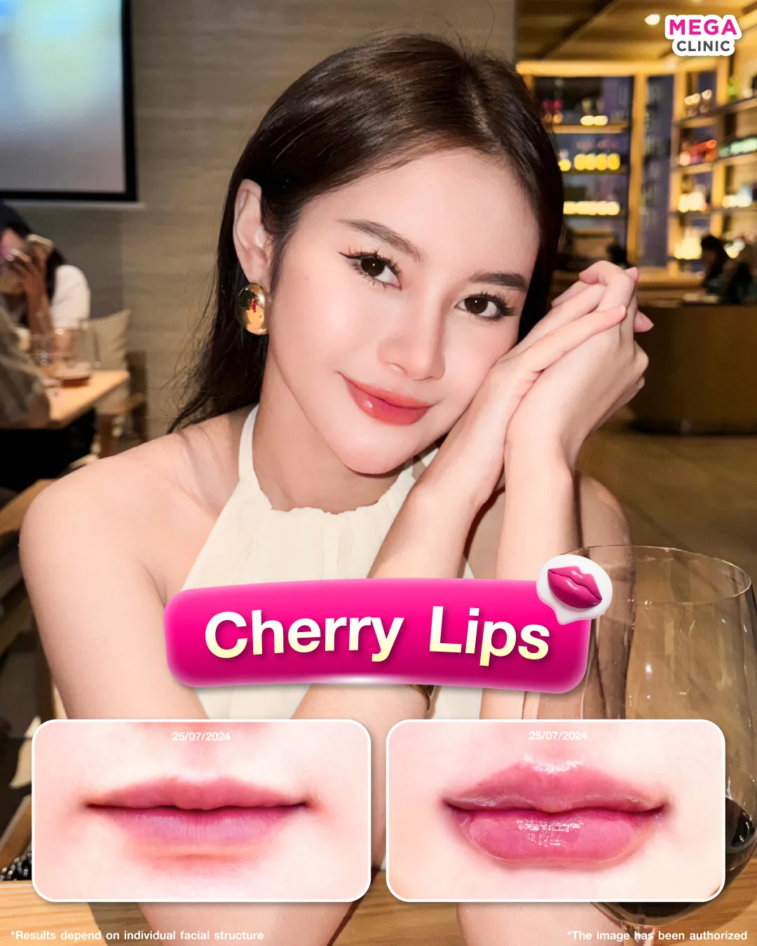 Cherry Lips