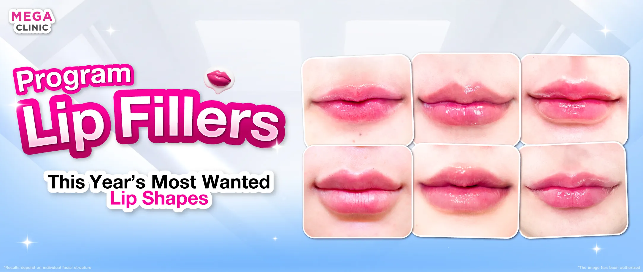 ฟิลเลอร์ปาก คืออะไร