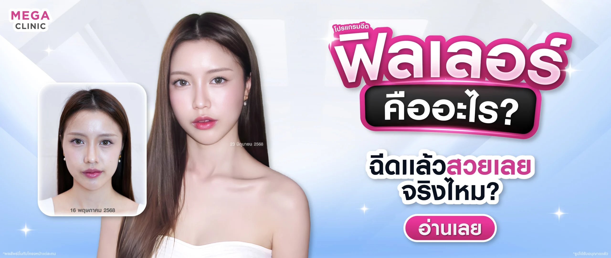 ฟิลเลอร์ คืออะไร