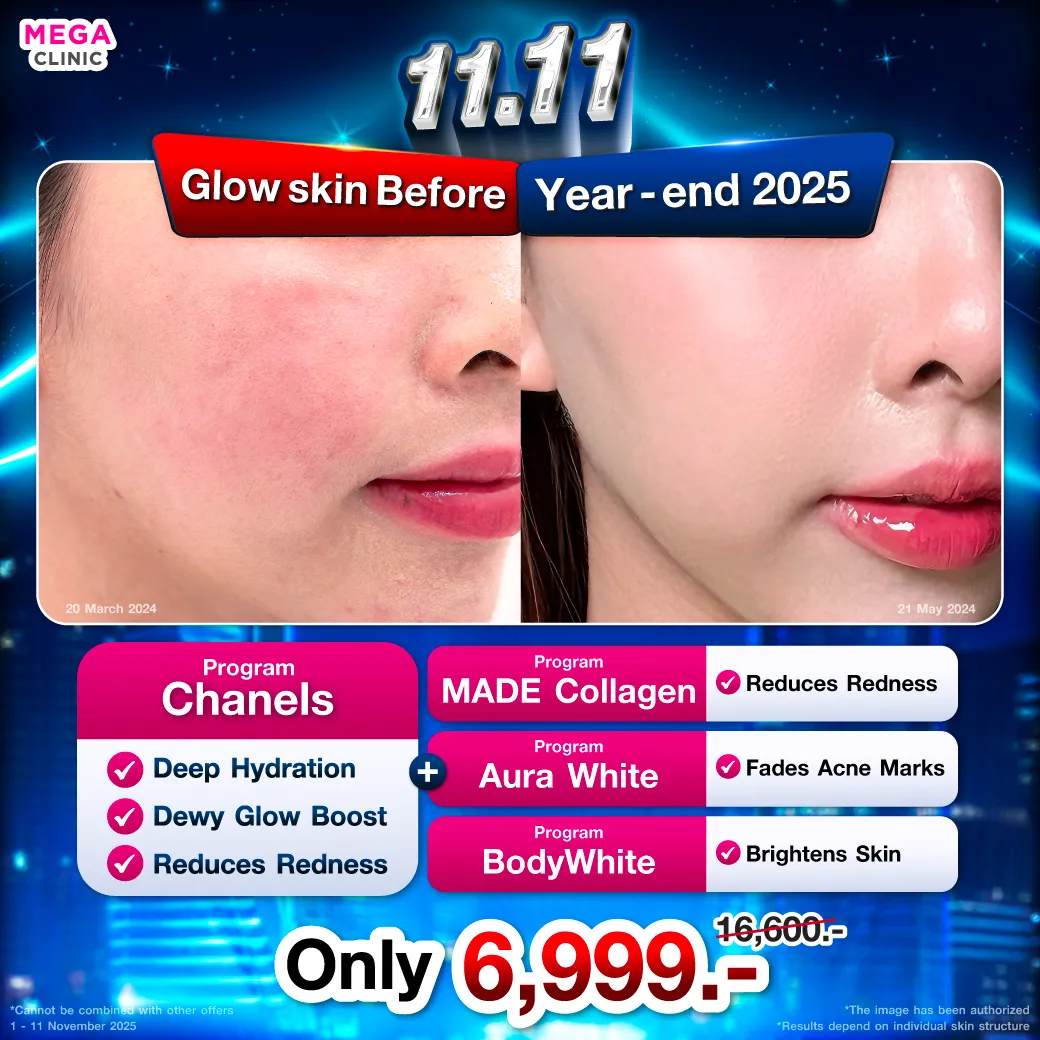 Web_แปล_31102025_Mickey_1_result