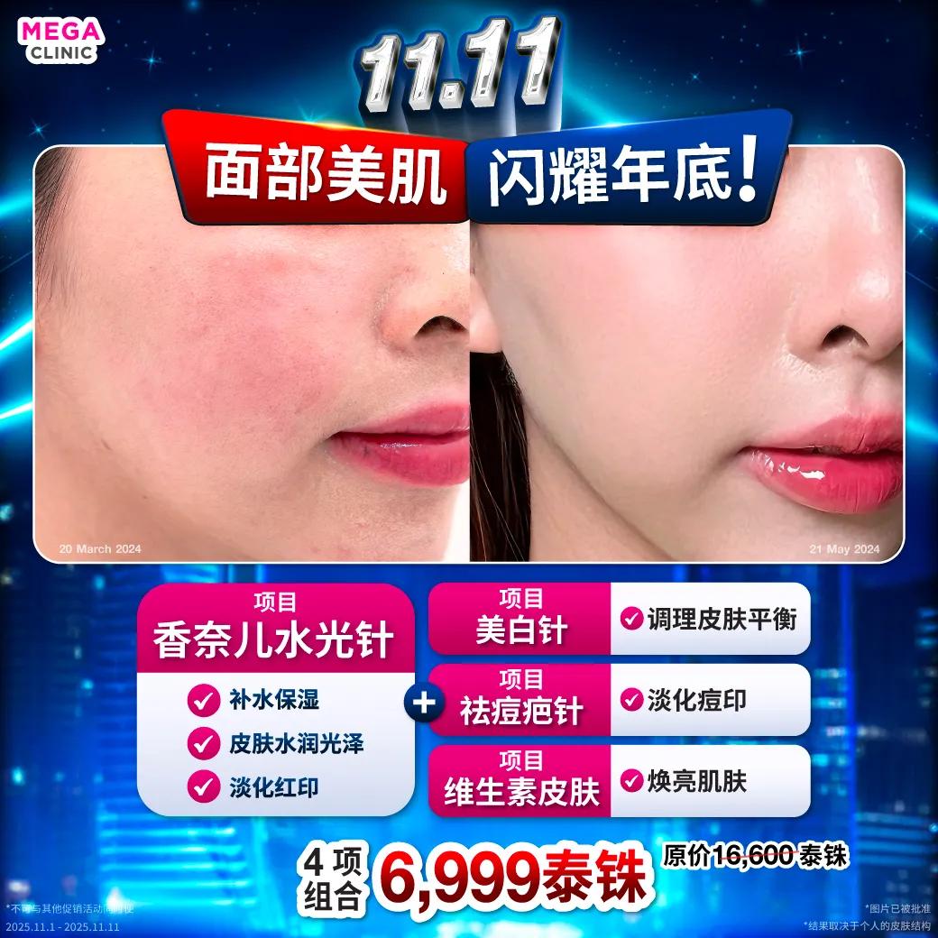 Web_แปล_31102025_Mickey_1_result